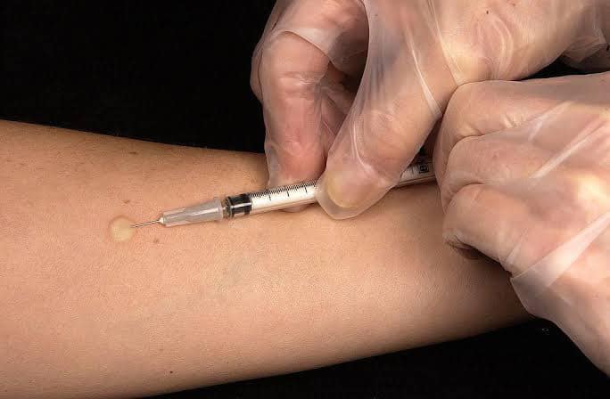 “หมอธีระวัฒน์” ชี้ฉีดวัคซีนเข้าชั้นผิวหนังประหยัดได้ 5 เท่า แถมมีผลข้างเคียงน้อย